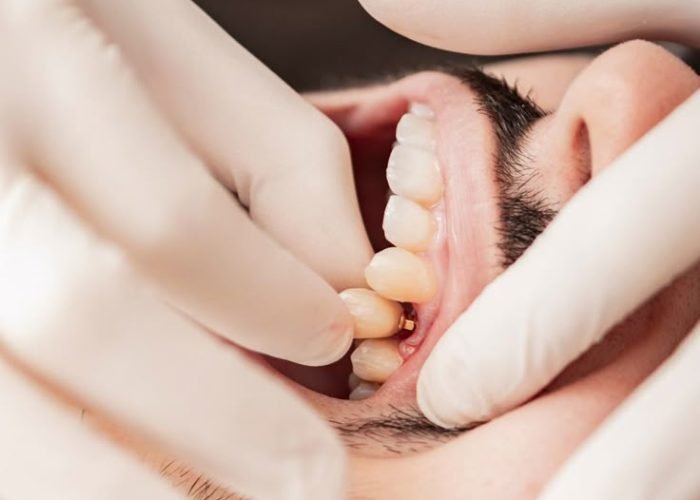 c93a5b1ab5d1a9a76662488df9c8fe2d